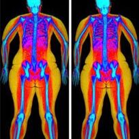 Bodyscan-scaled