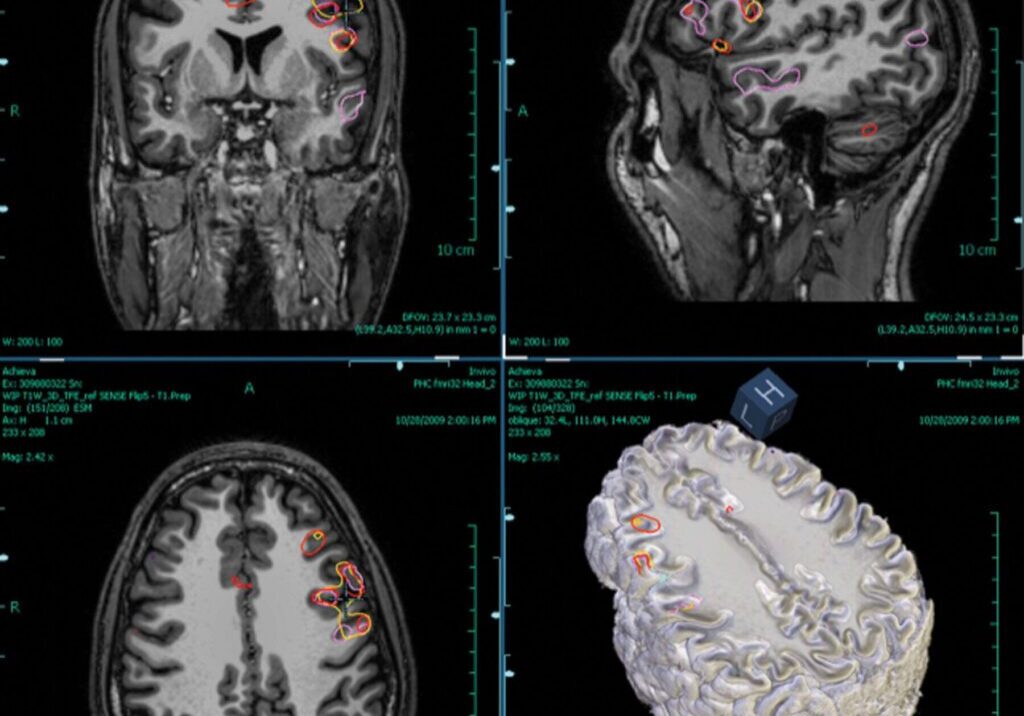 DSN_Brain-3-3-1800x1735